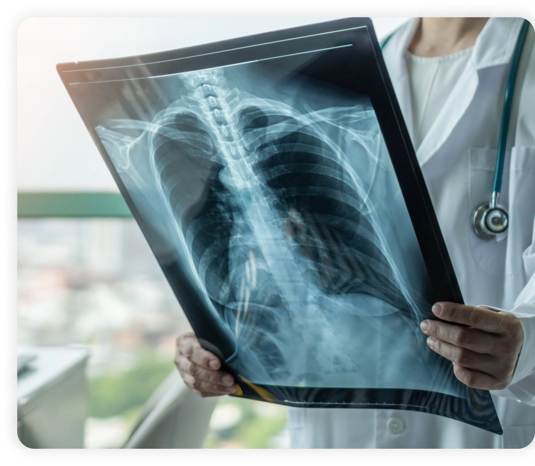 Digital X-Ray